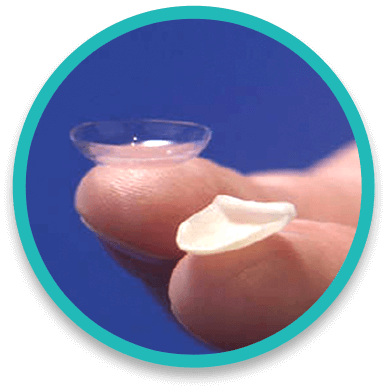 Contact lens thin porcelain veneers demonstration