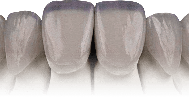 Decorative tooth illustration